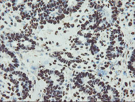 NONO Antibody in Immunohistochemistry (Paraffin) (IHC (P))