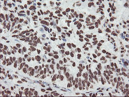 NONO Antibody in Immunohistochemistry (Paraffin) (IHC (P))