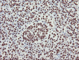 NONO Antibody in Immunohistochemistry (Paraffin) (IHC (P))