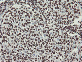 NONO Antibody in Immunohistochemistry (Paraffin) (IHC (P))