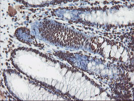 NONO Antibody in Immunohistochemistry (Paraffin) (IHC (P))