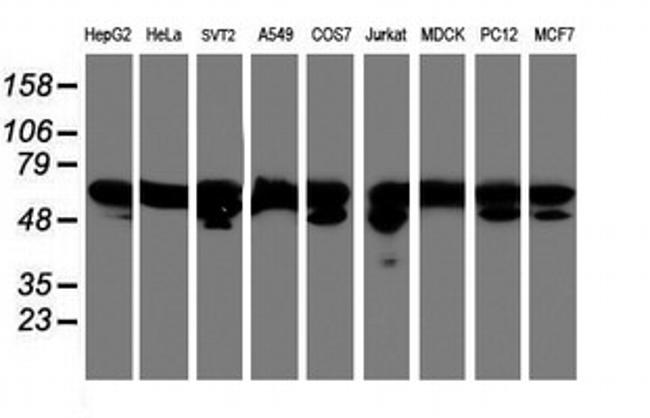 NONO Antibody in Western Blot (WB)