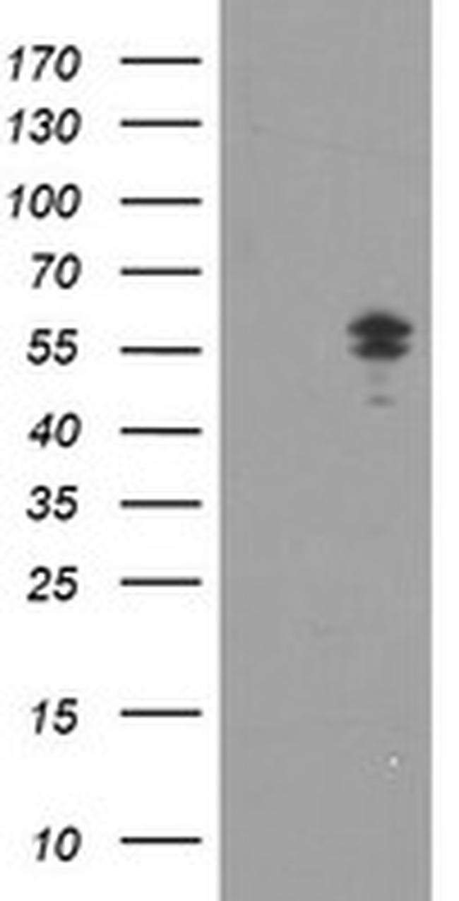 NONO Antibody in Western Blot (WB)