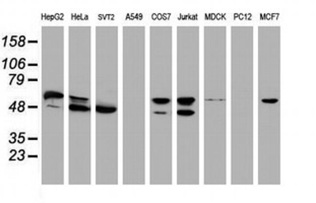 NONO Antibody in Western Blot (WB)