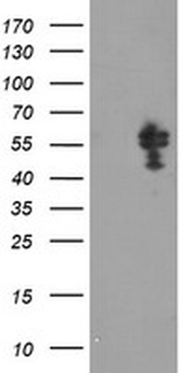 NONO Antibody in Western Blot (WB)