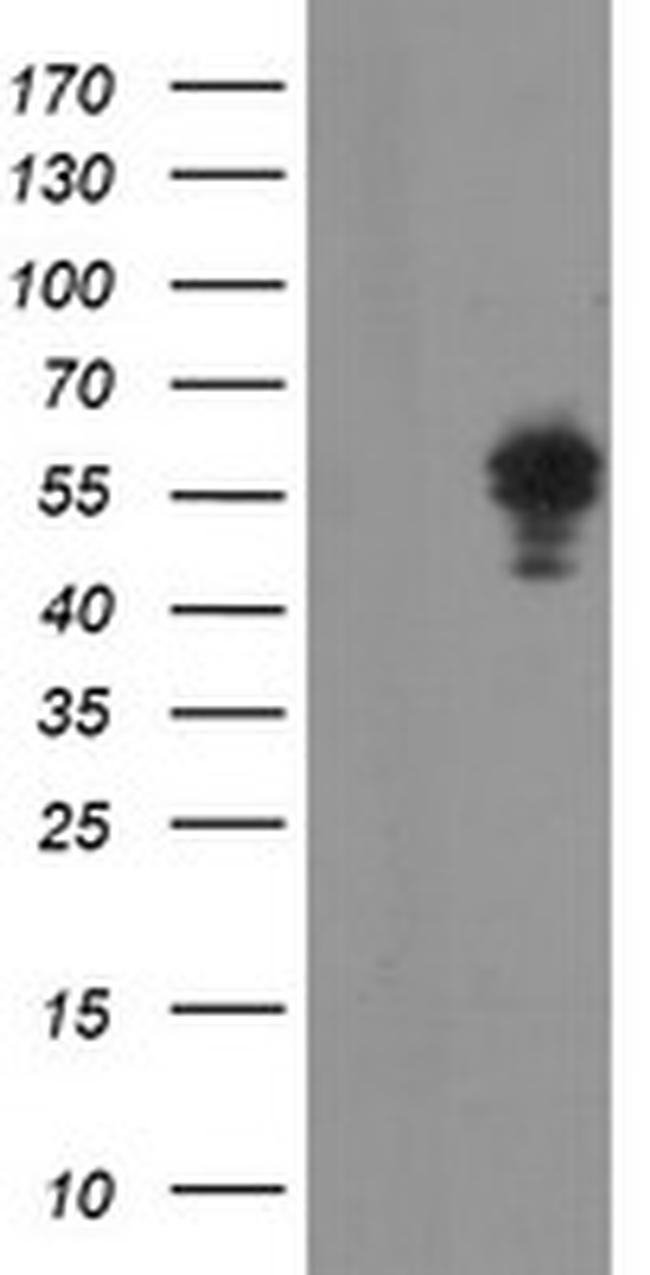 NONO Antibody in Western Blot (WB)