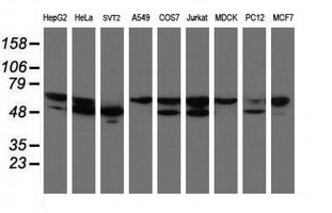 NONO Antibody in Western Blot (WB)