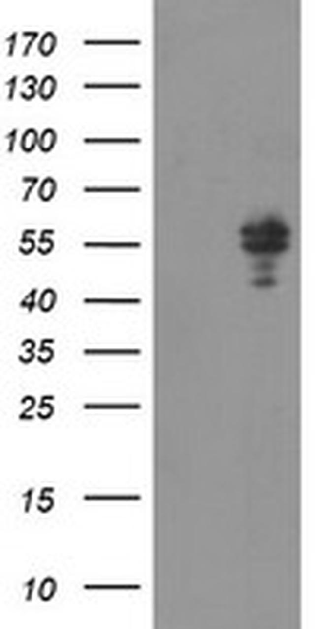 NONO Antibody in Western Blot (WB)