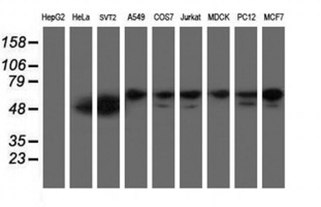 NONO Antibody in Western Blot (WB)