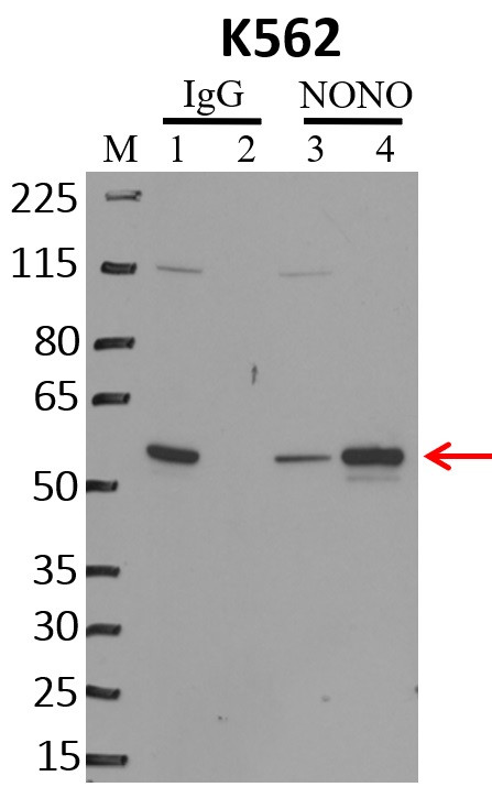 NONO Antibody in Immunoprecipitation (IP)