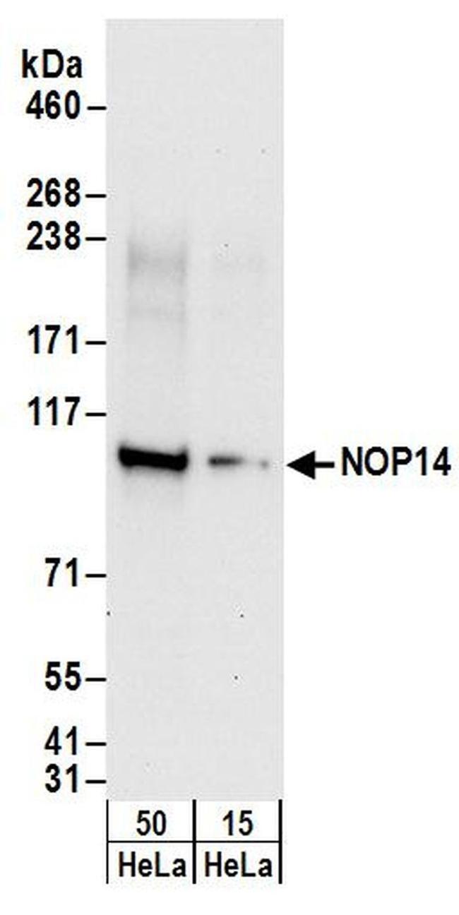 NOP14 Antibody in Western Blot (WB)