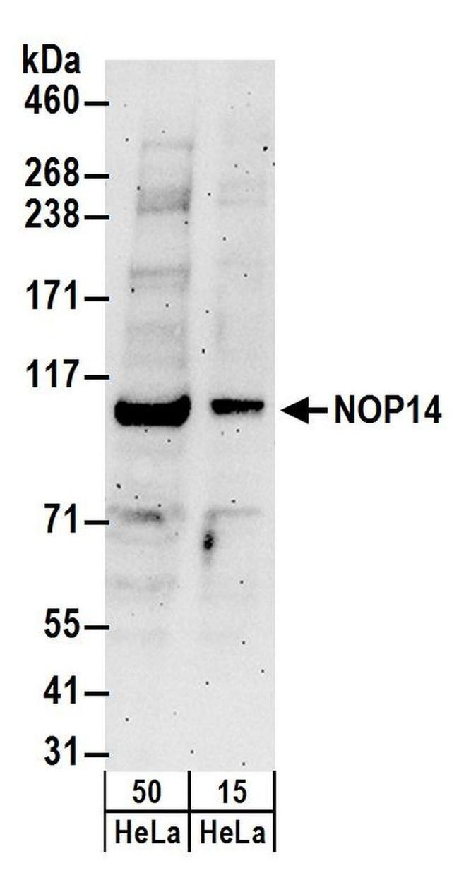 NOP14 Antibody in Western Blot (WB)