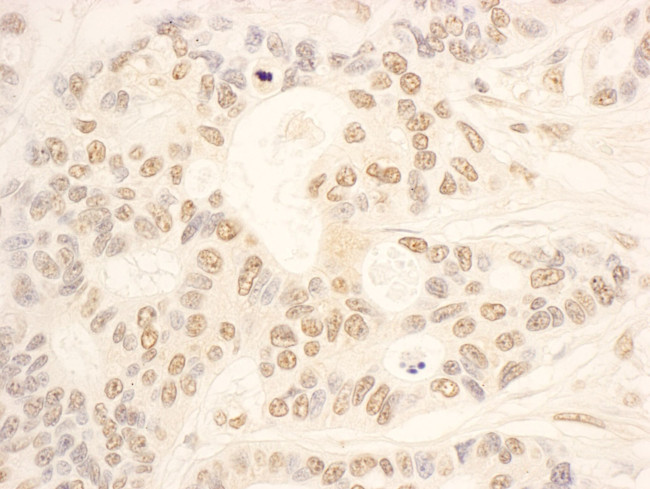 NOP58 Antibody in Immunohistochemistry (IHC)