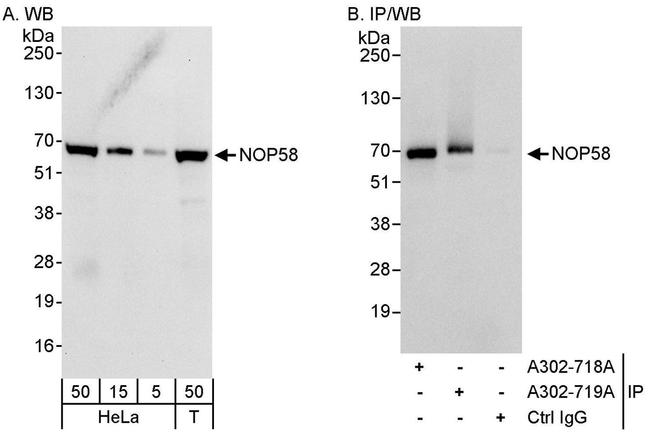 NOP58 Antibody in Western Blot (WB)