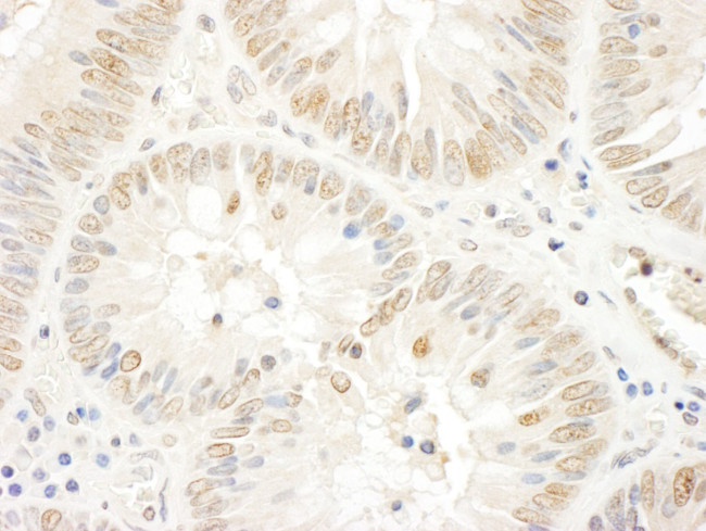 NOPP140 Antibody in Immunohistochemistry (IHC)