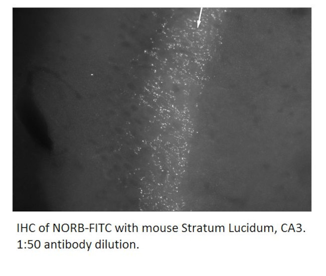 Neurochondrin Antibody in Immunohistochemistry (IHC)