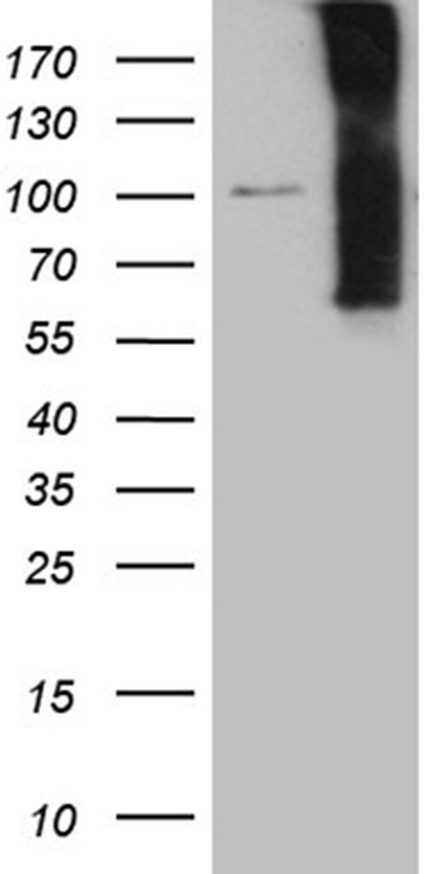 NOS1AP Antibody in Western Blot (WB)