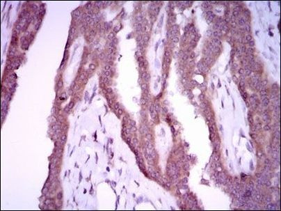 iNOS Antibody in Immunohistochemistry (Paraffin) (IHC (P))