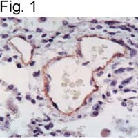 eNOS Antibody in Immunohistochemistry (IHC)