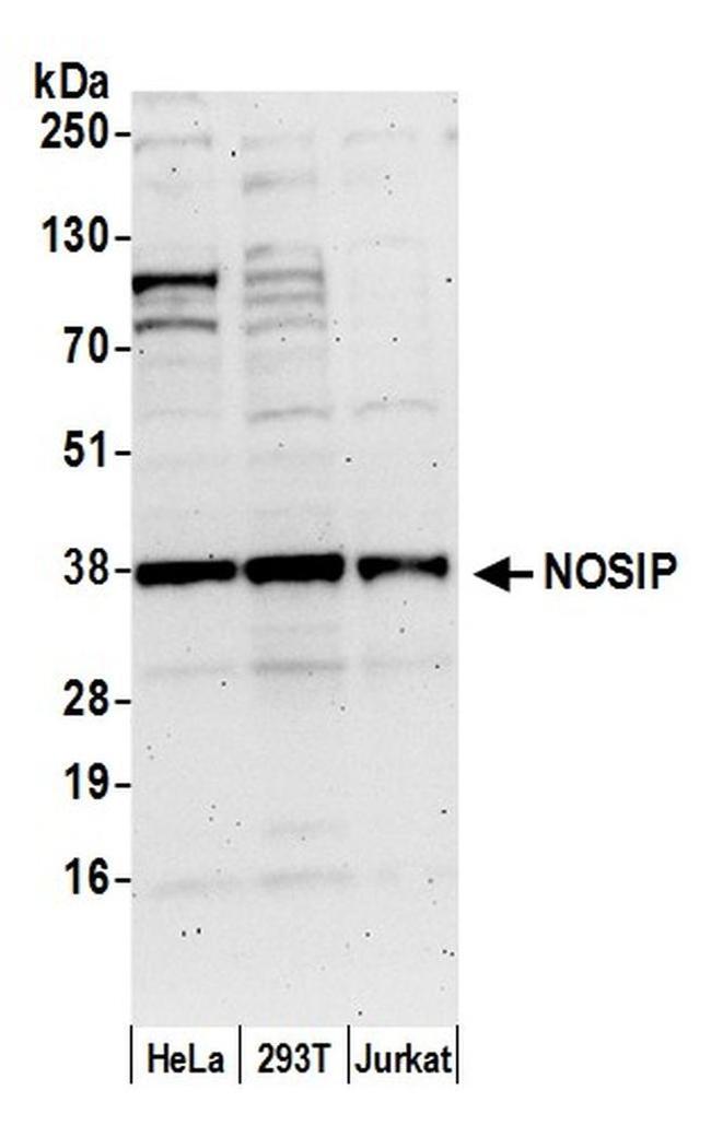 NOSIP Antibody in Western Blot (WB)