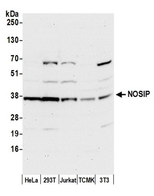 NOSIP Antibody in Western Blot (WB)