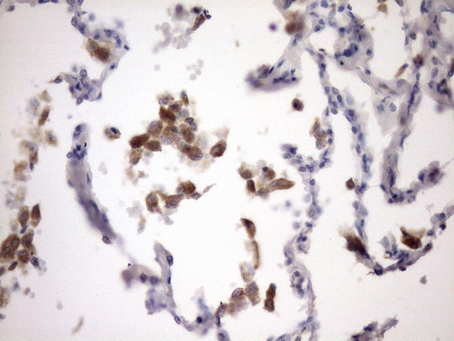 NOTCH1 Antibody in Immunohistochemistry (Paraffin) (IHC (P))