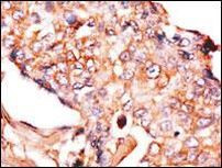 NPTX1 Antibody in Immunohistochemistry (IHC)