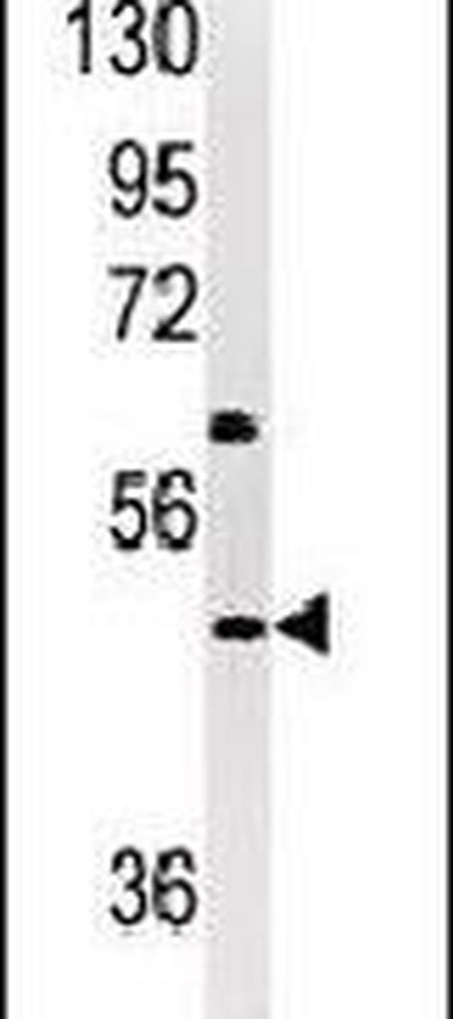 NPTX1 Antibody in Western Blot (WB)