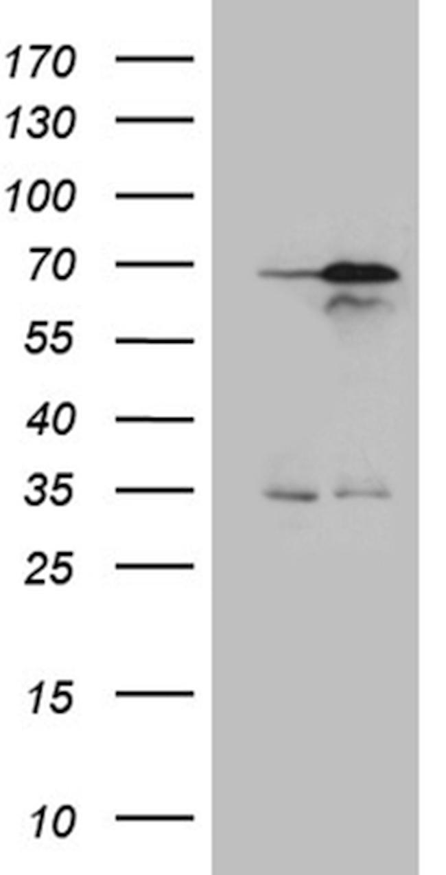 NPAS1 Antibody in Western Blot (WB)