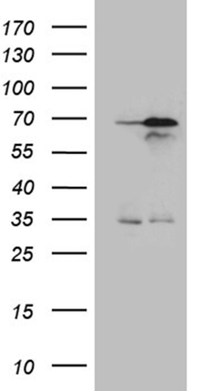 NPAS1 Antibody in Western Blot (WB)