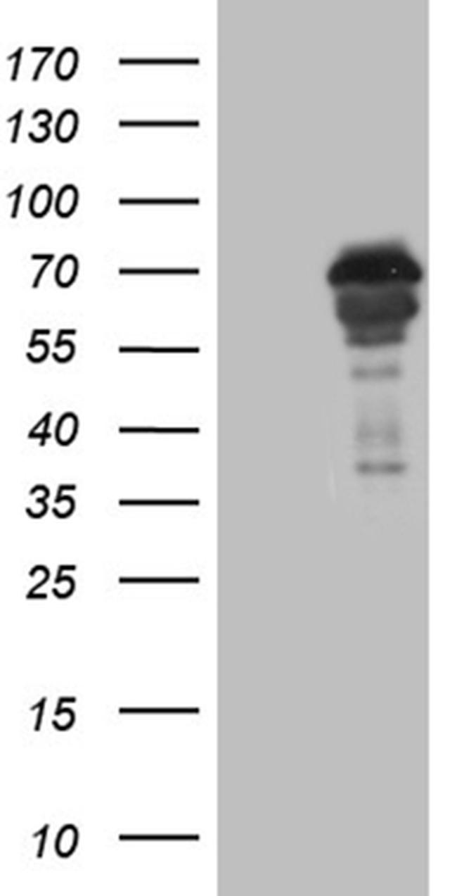 NPAS1 Antibody in Western Blot (WB)