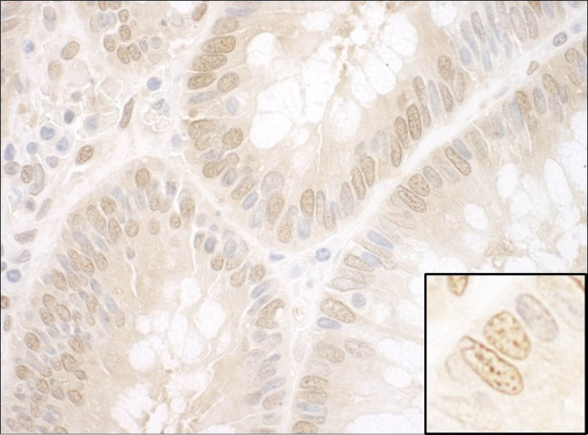 NPAT Antibody in Immunohistochemistry (IHC)