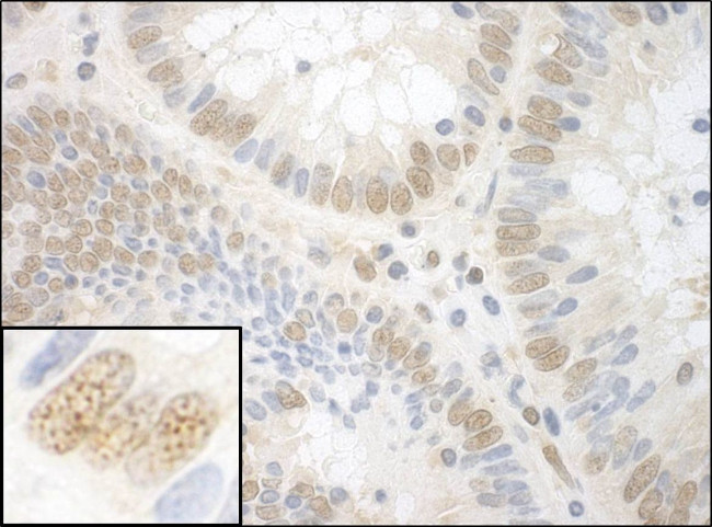 NPAT Antibody in Immunohistochemistry (IHC)