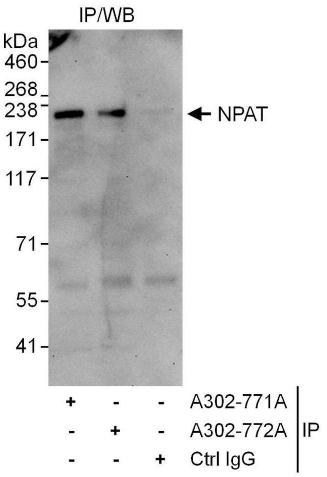 NPAT Antibody in Immunoprecipitation (IP)