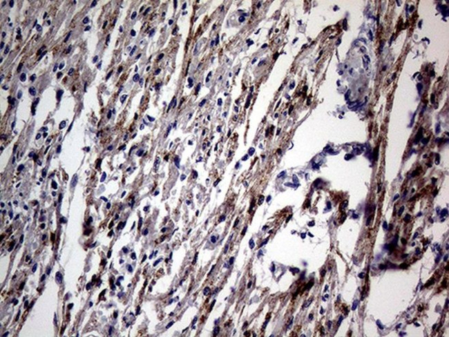 NPPA Antibody in Immunohistochemistry (Paraffin) (IHC (P))