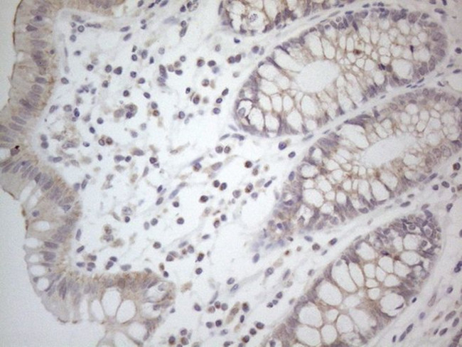 NPPB Antibody in Immunohistochemistry (Paraffin) (IHC (P))