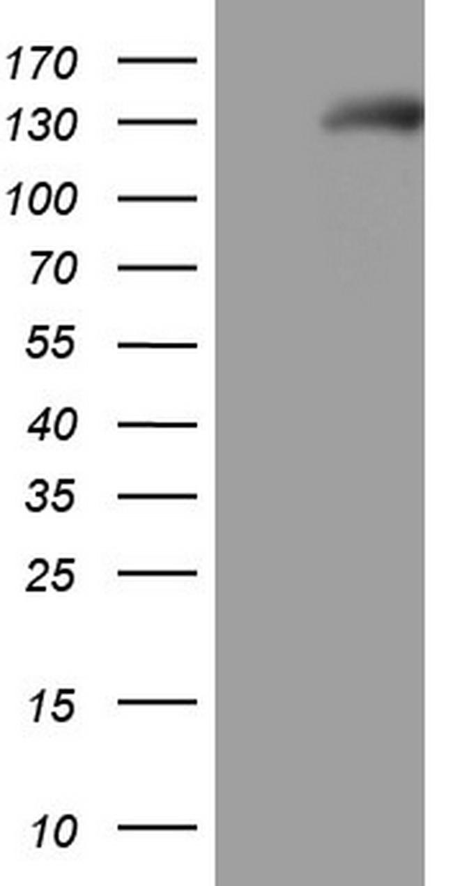 NPR1 Antibody in Western Blot (WB)