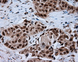 NPR3 Antibody in Immunohistochemistry (Paraffin) (IHC (P))