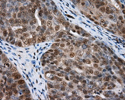 NPR3 Antibody in Immunohistochemistry (Paraffin) (IHC (P))