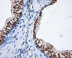 NPR3 Antibody in Immunohistochemistry (Paraffin) (IHC (P))