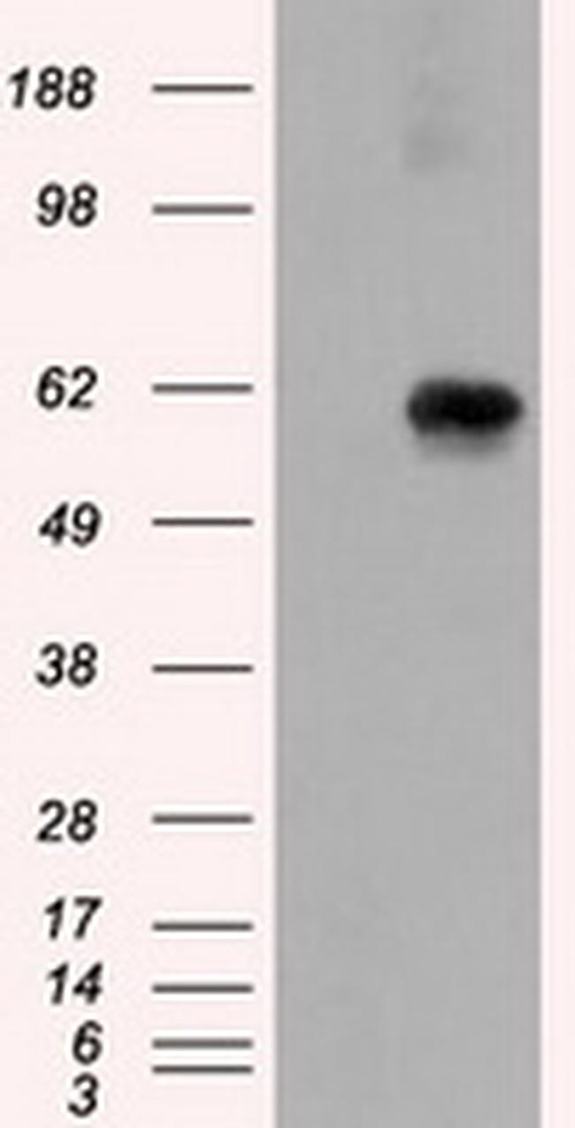 NPR3 Antibody in Western Blot (WB)