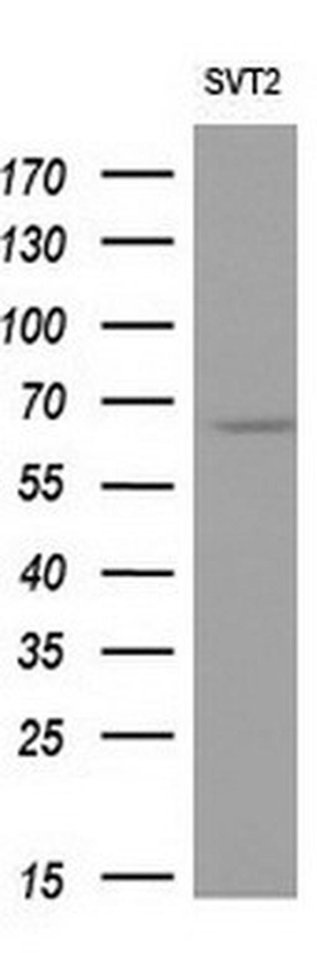 NPR3 Antibody in Western Blot (WB)