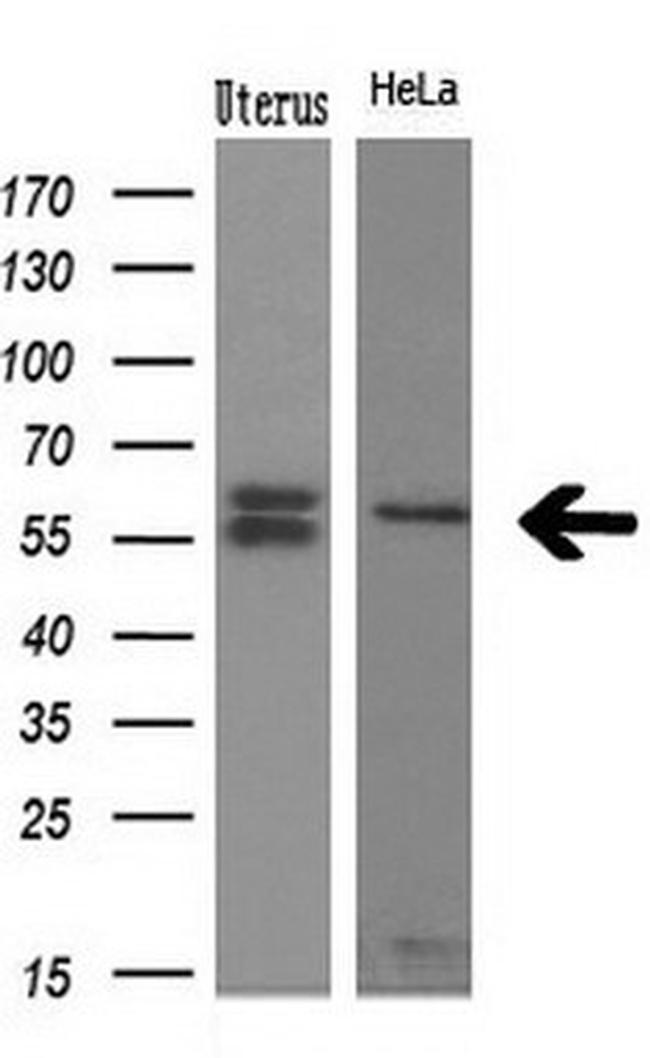 NPR3 Antibody in Western Blot (WB)