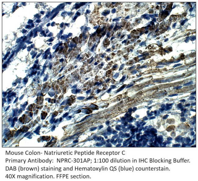 Natriuretic Peptide Receptor C Antibody in Immunohistochemistry (IHC)