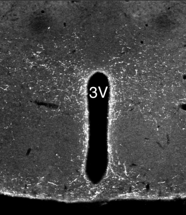 NPS Antibody in Immunohistochemistry (IHC)