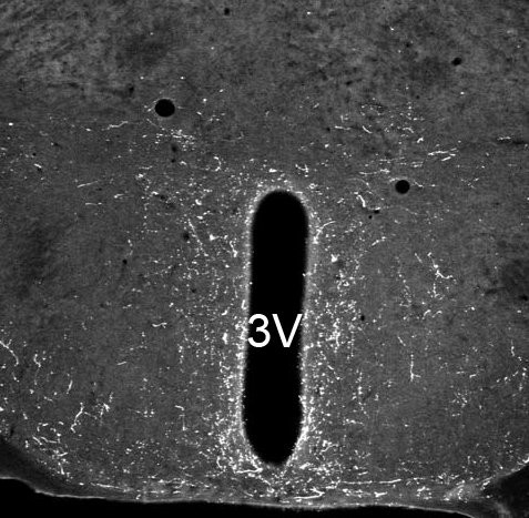 NPS Antibody in Immunohistochemistry (IHC)