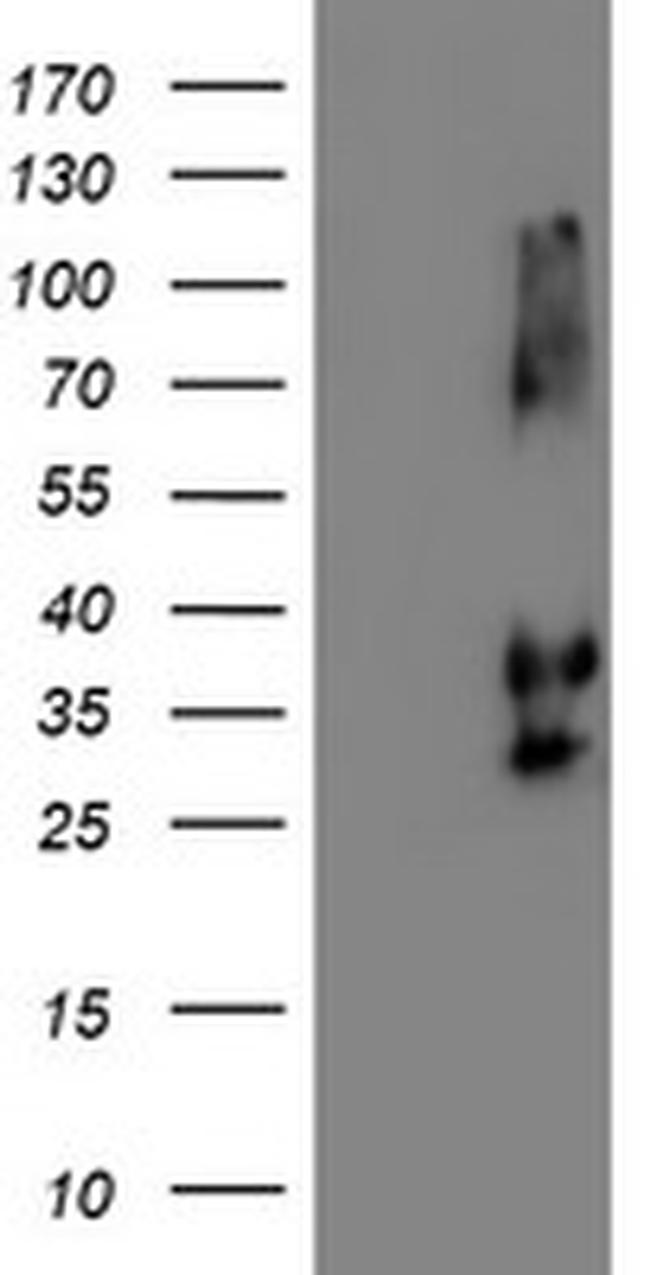 NPTN Antibody in Western Blot (WB)