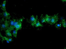 NQO2 Antibody in Immunocytochemistry (ICC/IF)