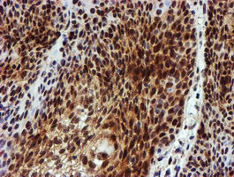 NQO2 Antibody in Immunohistochemistry (Paraffin) (IHC (P))