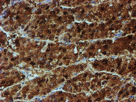 NQO2 Antibody in Immunohistochemistry (Paraffin) (IHC (P))